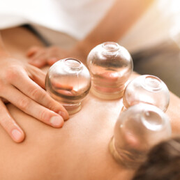 cupping therapie