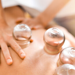 cupping therapie